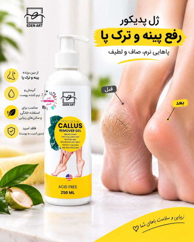 ژل کالوس ریموور ادن آرت پاک کننده پینه و ترک پا ها